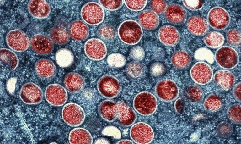 Mpox – Ευλογιά των πιθήκων: Γιατί προκαλεί μεγαλύτερη ανησυχία το νέο στέλεχος Clade 1b – Για ποιους συστήνεται το εμβόλιο